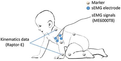 Degraded Synergistic Recruitment of sEMG Oscillations for Cerebral Palsy Infants Crawling